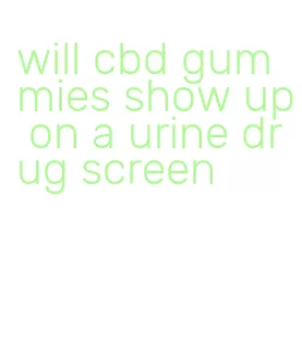 will cbd gummies show up on a urine drug screen