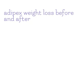 adipex weight loss before and after