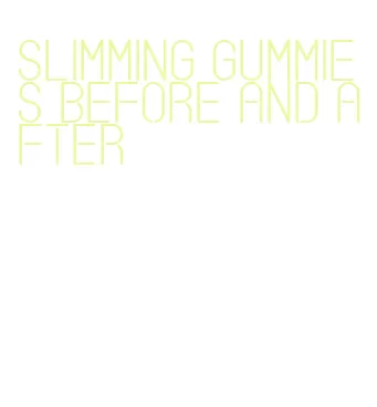 slimming gummies before and after