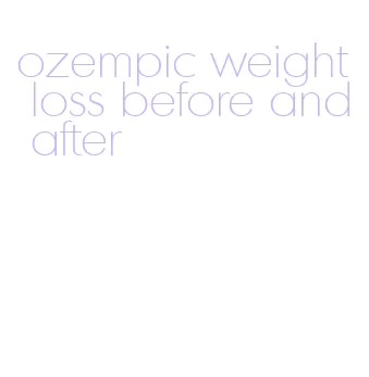 ozempic weight loss before and after