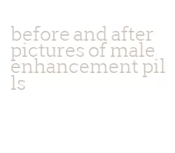 before and after pictures of male enhancement pills