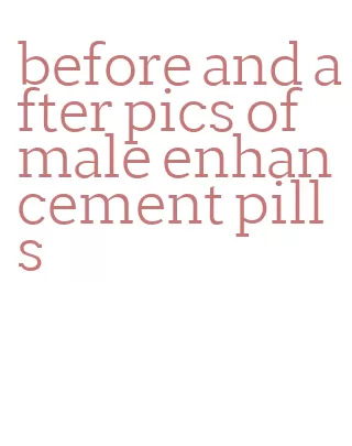 before and after pics of male enhancement pills