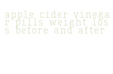 apple cider vinegar pills weight loss before and after