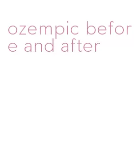 ozempic before and after