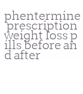 phentermine prescription weight loss pills before and after