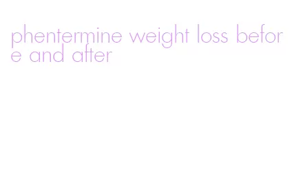 phentermine weight loss before and after