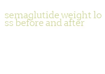 semaglutide weight loss before and after