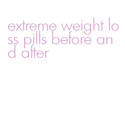 extreme weight loss pills before and after