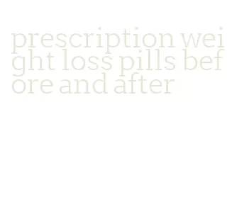 prescription weight loss pills before and after