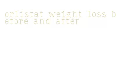 orlistat weight loss before and after