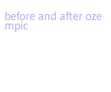 before and after ozempic