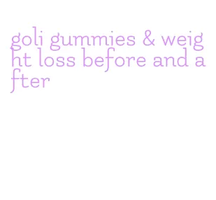 goli gummies & weight loss before and after