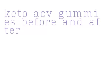 keto acv gummies before and after