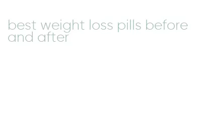 best weight loss pills before and after